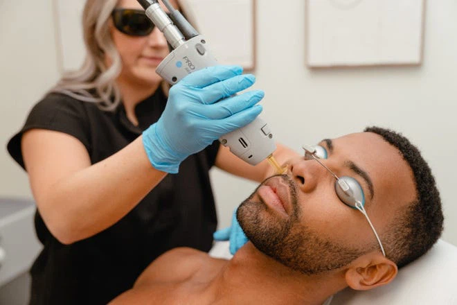 laser hair removal laser hair removal